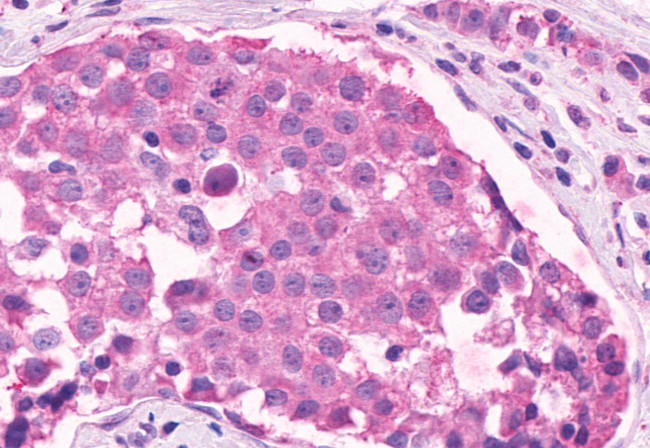 OR2A4 Antibody in Immunohistochemistry (Paraffin) (IHC (P))