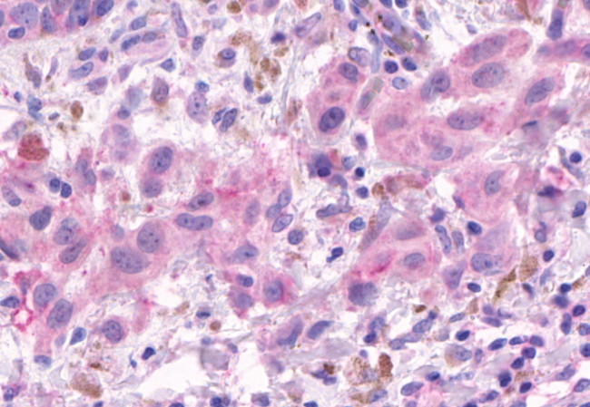 OR2A4 Antibody in Immunohistochemistry (Paraffin) (IHC (P))