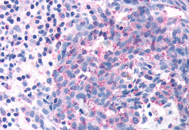 OR2A4 Antibody in Immunohistochemistry (Paraffin) (IHC (P))