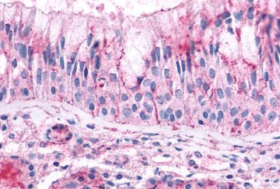 OR2A4 Antibody in Immunohistochemistry (Paraffin) (IHC (P))