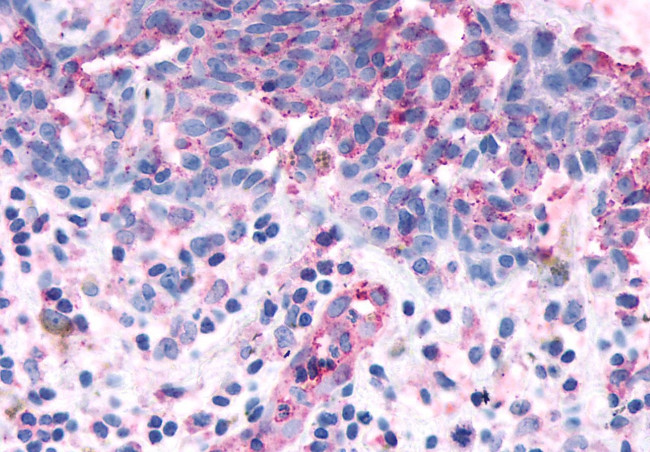 OR2A4 Antibody in Immunohistochemistry (Paraffin) (IHC (P))