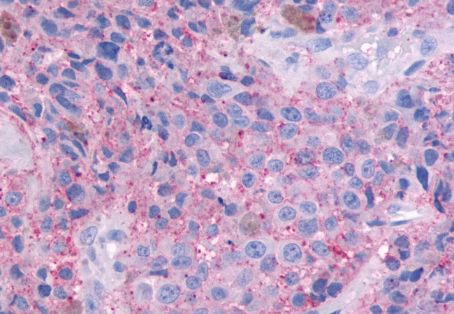 OR51E1 Antibody in Immunohistochemistry (Paraffin) (IHC (P))