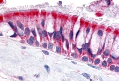 OR6N1 Antibody in Immunohistochemistry (Paraffin) (IHC (P))