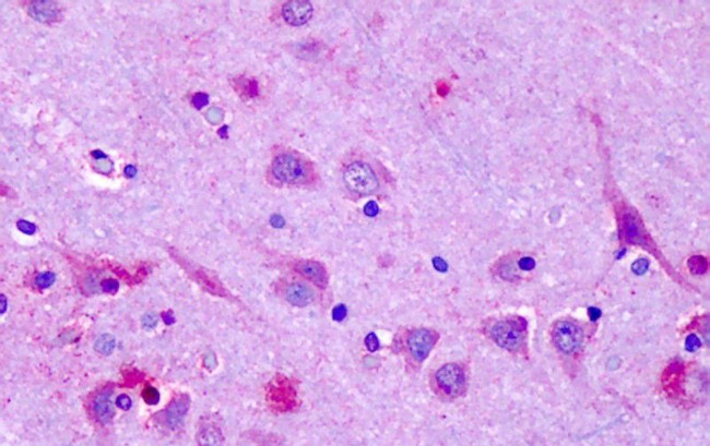 OR6N1 Antibody in Immunohistochemistry (Paraffin) (IHC (P))