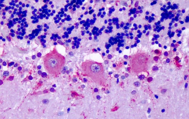 OR6N1 Antibody in Immunohistochemistry (Paraffin) (IHC (P))