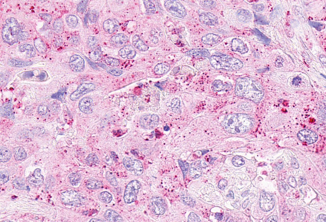 OXER1 Antibody in Immunohistochemistry (Paraffin) (IHC (P))