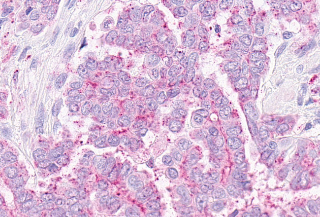 OXER1 Antibody in Immunohistochemistry (Paraffin) (IHC (P))