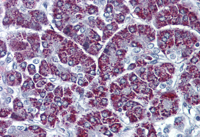 P2X3 Antibody in Immunohistochemistry (Paraffin) (IHC (P))