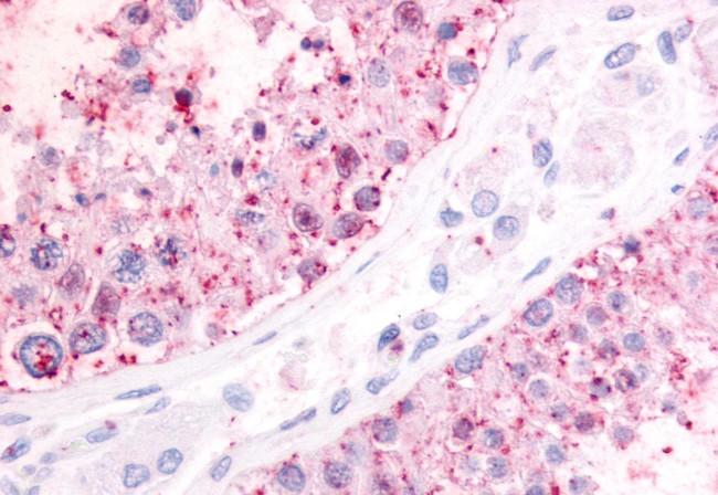 P2Y1 Antibody in Immunohistochemistry (Paraffin) (IHC (P))