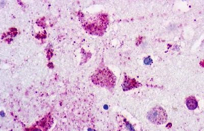 P2Y1 Antibody in Immunohistochemistry (Paraffin) (IHC (P))