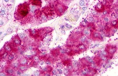 P2Y1 Antibody in Immunohistochemistry (Paraffin) (IHC (P))