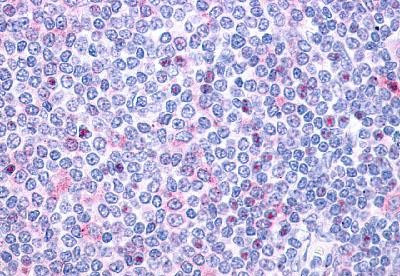 P2Y10 Antibody in Immunohistochemistry (Paraffin) (IHC (P))