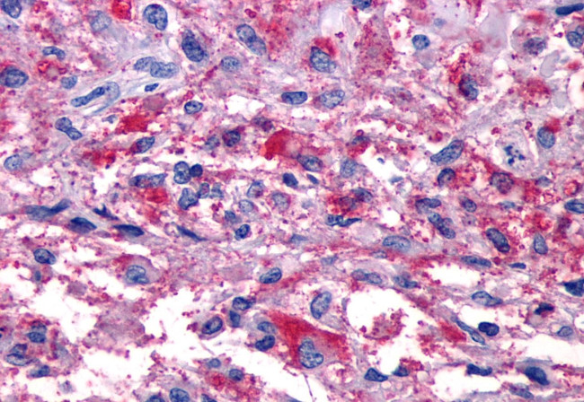 P2Y11 Antibody in Immunohistochemistry (Paraffin) (IHC (P))