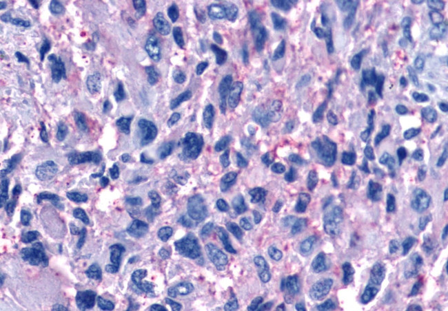 P2Y11 Antibody in Immunohistochemistry (Paraffin) (IHC (P))