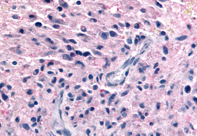 P2Y12 Antibody in Immunohistochemistry (Paraffin) (IHC (P))