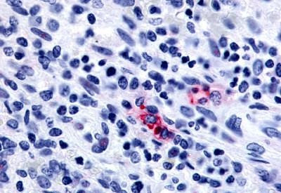 P2Y13 Antibody in Immunohistochemistry (Paraffin) (IHC (P))