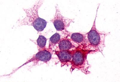 P2Y14 Antibody in Immunocytochemistry (ICC/IF)