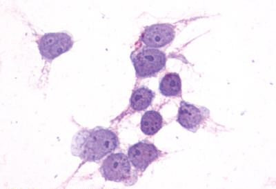 P2Y14 Antibody in Immunocytochemistry (ICC/IF)