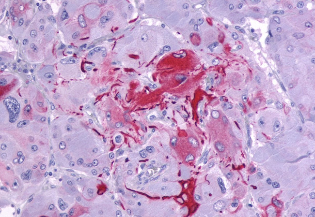 P2Y14 Antibody in Immunohistochemistry (Paraffin) (IHC (P))