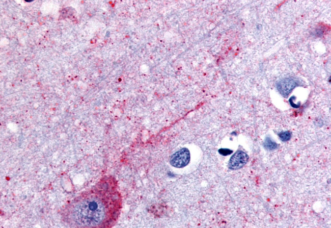 P2Y14 Antibody in Immunohistochemistry (Paraffin) (IHC (P))