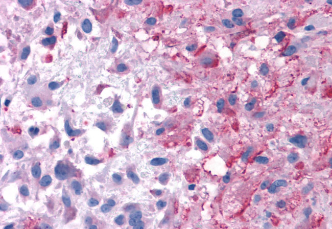 P2Y14 Antibody in Immunohistochemistry (Paraffin) (IHC (P))