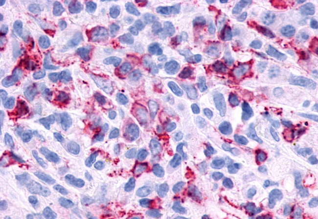 P2Y6 Antibody in Immunohistochemistry (Paraffin) (IHC (P))