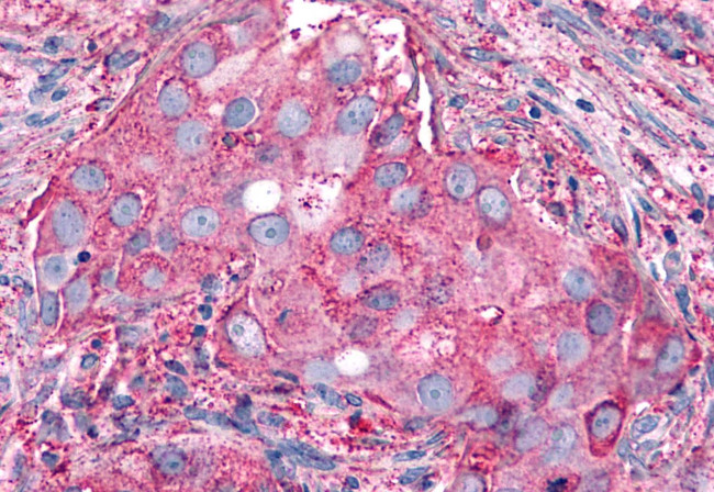 P2Y6 Antibody in Immunohistochemistry (Paraffin) (IHC (P))