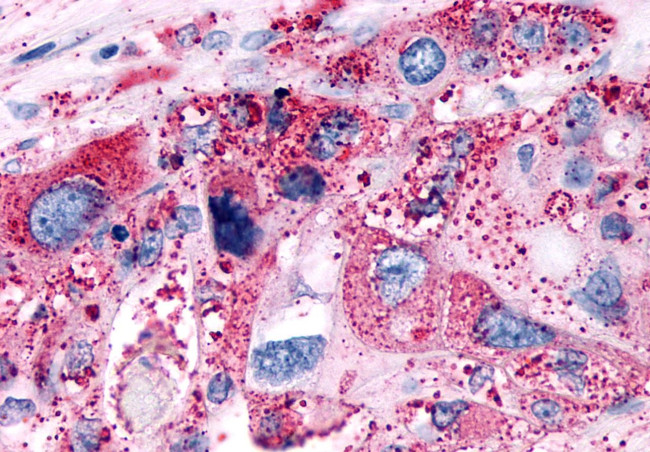 P2Y6 Antibody in Immunohistochemistry (Paraffin) (IHC (P))