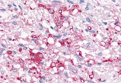 P2Y6 Antibody in Immunohistochemistry (Paraffin) (IHC (P))