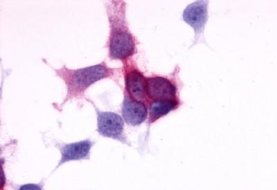 P2Y6 Antibody in Immunocytochemistry (ICC/IF)