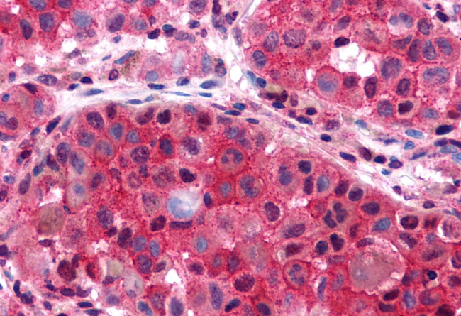 P2Y6 Antibody in Immunohistochemistry (Paraffin) (IHC (P))