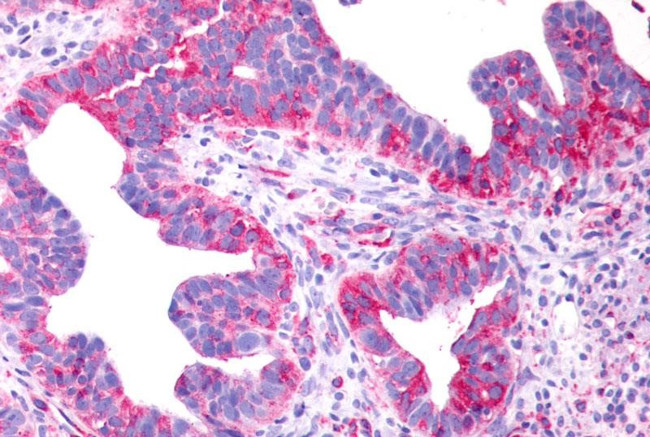 P2Y8 Antibody in Immunohistochemistry (Paraffin) (IHC (P))