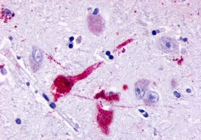 P2Y8 Antibody in Immunohistochemistry (Paraffin) (IHC (P))