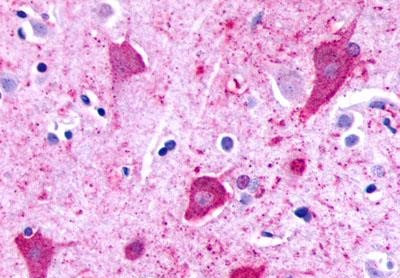 P2Y8 Antibody in Immunohistochemistry (Paraffin) (IHC (P))