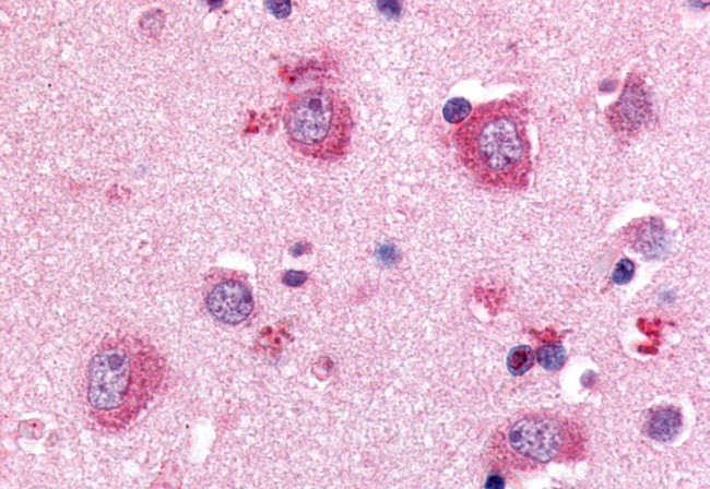 P2Y8 Antibody in Immunohistochemistry (Paraffin) (IHC (P))