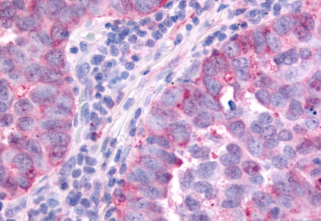 PAK6 Antibody in Immunohistochemistry (Paraffin) (IHC (P))