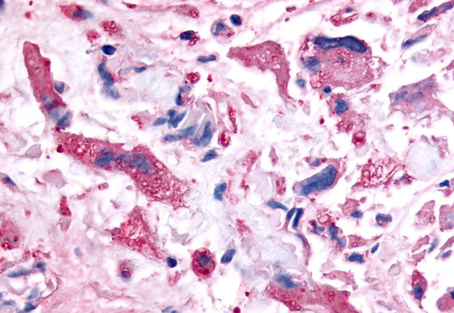 PAK6 Antibody in Immunohistochemistry (Paraffin) (IHC (P))