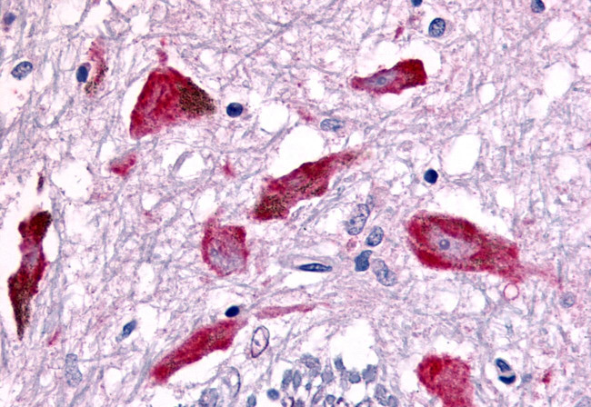 PAK7 Antibody in Immunohistochemistry (Paraffin) (IHC (P))