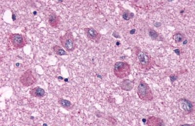 NPY4R Antibody in Immunohistochemistry (Paraffin) (IHC (P))