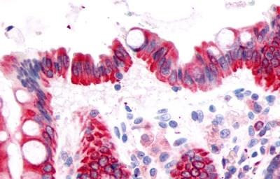 PTGDR Antibody in Immunohistochemistry (Paraffin) (IHC (P))