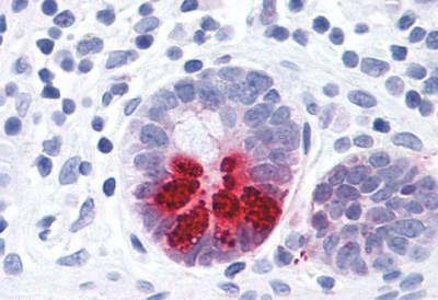 PTGDR Antibody in Immunohistochemistry (Paraffin) (IHC (P))