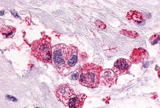 PTGER3 Antibody in Immunohistochemistry (Paraffin) (IHC (P))