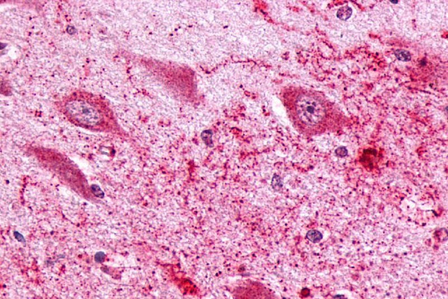 PTGER3 Antibody in Immunohistochemistry (Paraffin) (IHC (P))