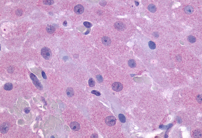 PTGFR Antibody in Immunohistochemistry (Paraffin) (IHC (P))