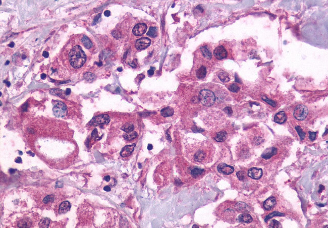 PTGFR Antibody in Immunohistochemistry (Paraffin) (IHC (P))