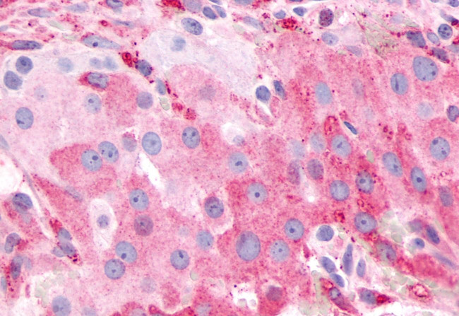 PTGFR Antibody in Immunohistochemistry (Paraffin) (IHC (P))