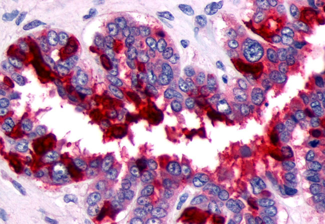 PTGFR Antibody in Immunohistochemistry (Paraffin) (IHC (P))