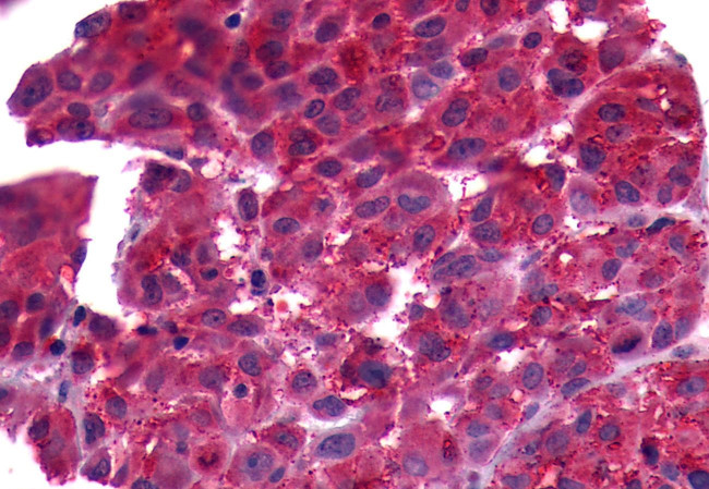 PTGFR Antibody in Immunohistochemistry (Paraffin) (IHC (P))