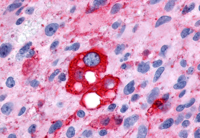 PTGFR Antibody in Immunohistochemistry (Paraffin) (IHC (P))