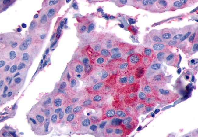 PTGFR Antibody in Immunohistochemistry (Paraffin) (IHC (P))